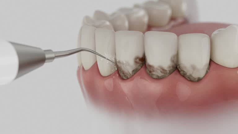 Trusted Tooth Extraction service in Seabrook, SC - Dentist Open Now